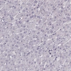 Immunohistochemical staining of human liver shows no positivity in hepatocytes as expected.