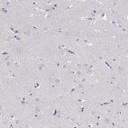 Immunohistochemical staining of human cerebral cortex shows no positivity in neurons as expected.