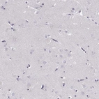 Immunohistochemical staining of human cerebral cortex shows no positivity in neurons as expected.