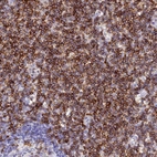 Immunohistochemical staining of human lymph node shows strong membranous positivity in non-germinal center cells.