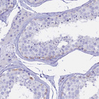 Anti-CD5 Antibody