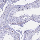 Immunohistochemical staining of human testis shows moderate membranous positivity in a subset of spermatogonia.