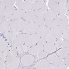 Anti-CD5 Antibody