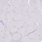 Immunohistochemical staining of human skeletal muscle shows no positivity in myocytes as expected.