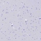 Immunohistochemical staining of human cerebral cortex shows no positivity in neurons as expected.