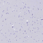 Anti-CD5 Antibody