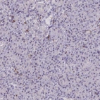 Immunohistochemical staining of human pancreas shows low expression as expected.