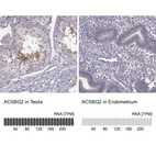 Anti-ACSBG2 Antibody