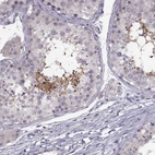 Immunohistochemical staining of human testis shows high expression.