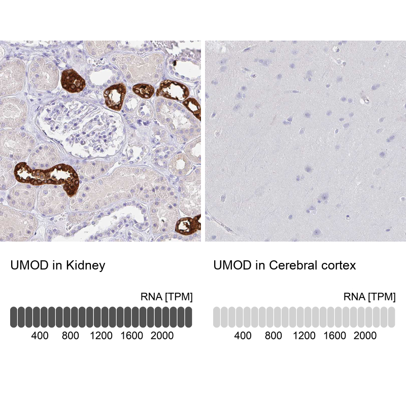 Anti-UMOD Antibody