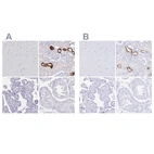 Immunohistochemical staining of human cerebral cortex, kidney, placenta and testis using Anti-UMOD antibody HPA043420 (A) shows similar protein distribution across tissues to independent antibody HPA054721 (B).