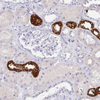 Immunohistochemical staining of human kidney shows strong cytoplasmic positivity in cells in tubules.