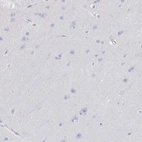Immunohistochemical staining of human cerebral cortex shows no positivity in neurons as expected.