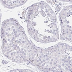 Immunohistochemical staining of human testis shows no positivity in cells in seminiferous ducts as expected.