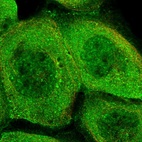 Immunofluorescent staining of human cell line A-431 shows localization to nuclear speckles, plasma membrane & cytosol.