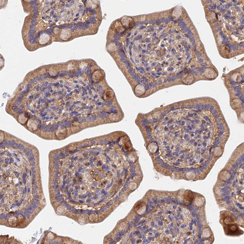 Anti-SLC38A11 Antibody