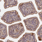 Anti-SLC38A11 Antibody