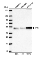Western blot analysis in U2OS cells transfected with control siRNA, target specific siRNA probe #1 and #2, using Anti-KRR1 antibody. Remaining relative intensity is presented.