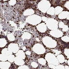 Anti-ARHGEF2 Antibody