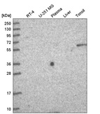 Anti-TTC39A Antibody