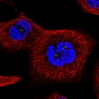 Anti-TTC39A Antibody