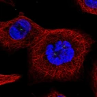Immunofluorescent staining of human cell line A-431 shows localization to centrosome.