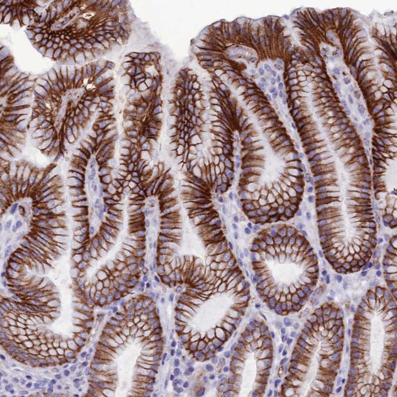 Anti-CDC42EP5 Antibody