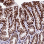 Anti-CDC42EP5 Antibody