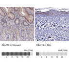 Anti-C4orf19 Antibody