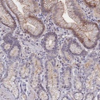 Anti-C4orf19 Antibody