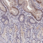 Immunohistochemical staining of human stomach shows high expression.