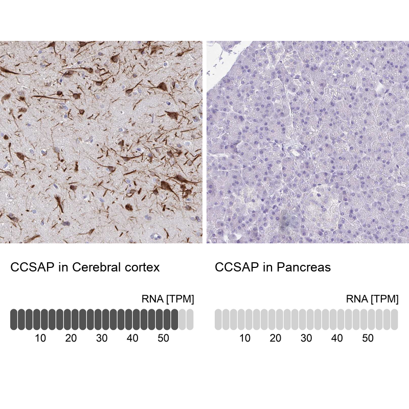 Anti-CCSAP Antibody