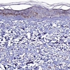 Immunohistochemical staining of human skin shows low expression as expected.