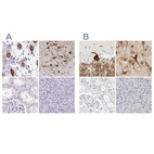 Immunohistochemical staining of human cerebellum, cerebral cortex, kidney and pancreas using Anti-CCSAP antibody HPA043443 (A) shows similar protein distribution across tissues to independent antibody HPA028402 (B).