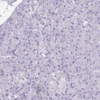 Immunohistochemical staining of human pancreas shows low expression as expected.