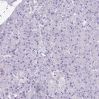 Immunohistochemical staining of human pancreas shows low expression as expected.