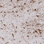 Immunohistochemical staining of human cerebral cortex shows high expression.