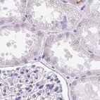 Immunohistochemical staining of human kidney using Anti-CCSAP antibody HPA043443.