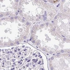 Immunohistochemical staining of human kidney using Anti-CCSAP antibody HPA043443.