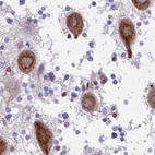 Immunohistochemical staining of human cerebellum using Anti-CCSAP antibody HPA043443.