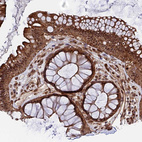 Immunohistochemical staining of human rectum shows strong nuclear and cytoplasmic positivity in glandular cells.