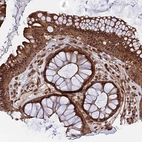 Immunohistochemical staining of human rectum shows strong nuclear and cytoplasmic positivity in glandular cells.