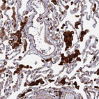 Immunohistochemical staining of human lung shows strong cytoplasmic positivity in macrophages.