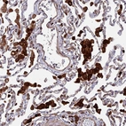 Immunohistochemical staining of human lung shows strong cytoplasmic positivity in macrophages.