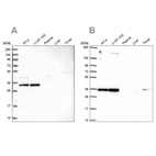 Western blot analysis using Anti-NOSIP antibody HPA043464 (A) shows similar pattern to independent antibody HPA062132 (B).