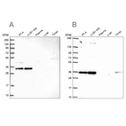 Western blot analysis using Anti-NOSIP antibody HPA043464 (A) shows similar pattern to independent antibody HPA062132 (B).