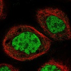 Immunofluorescent staining of human cell line A-431 shows localization to nucleoplasm.