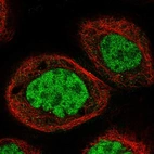 Immunofluorescent staining of human cell line A-431 shows localization to nucleoplasm.