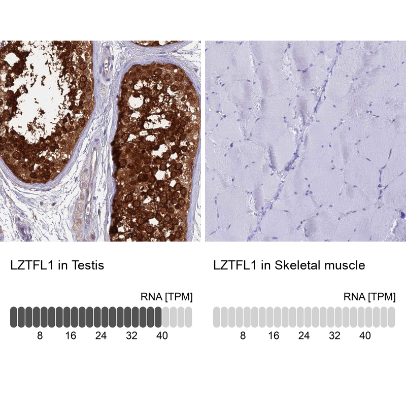 Anti-LZTFL1 Antibody