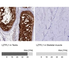 Anti-LZTFL1 Antibody